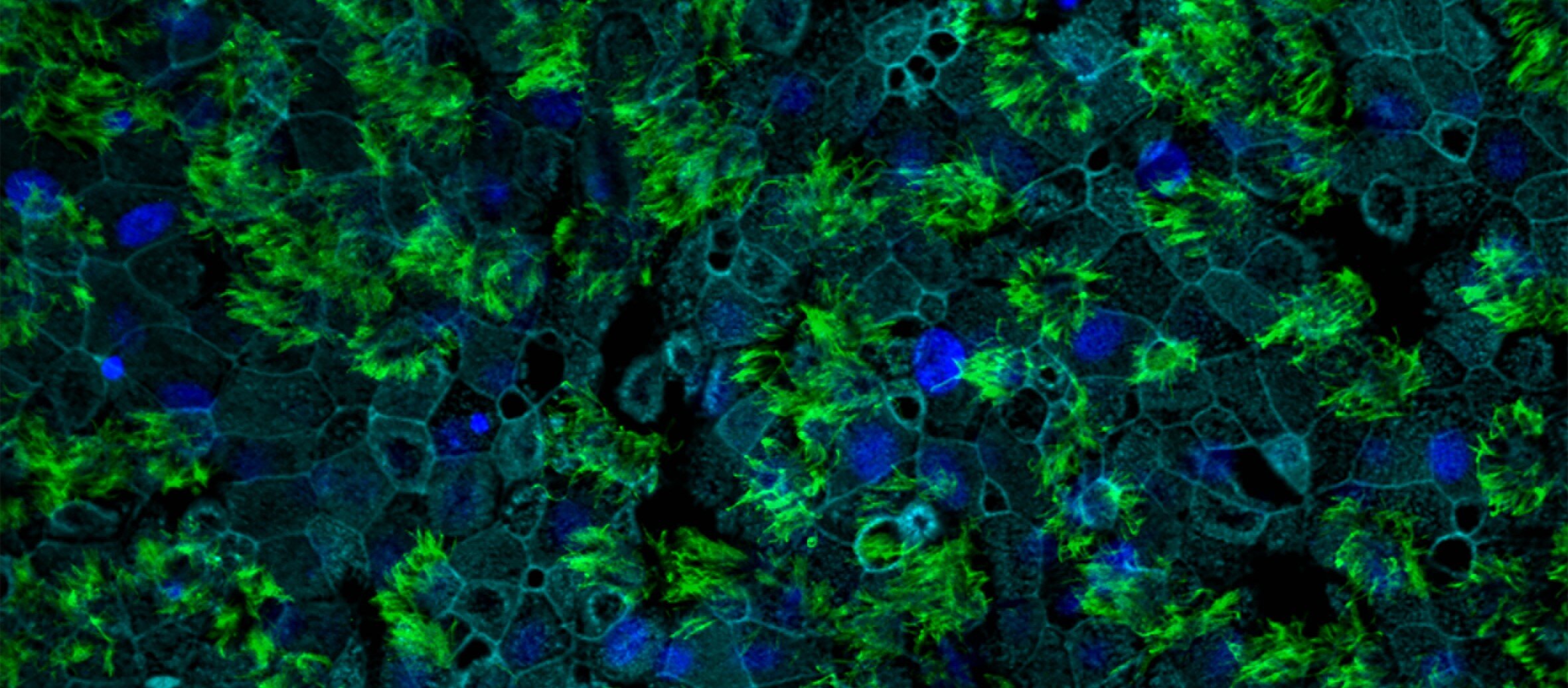 Phát hiện mới về các thụ thể khiến virus corona dễ xâm nhập tế bào người