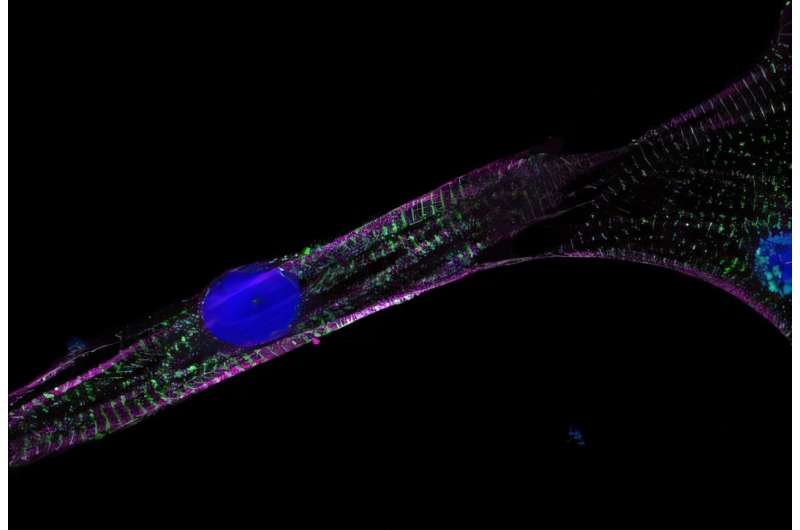 Sàng lọc gene giúp tìm nguyên nhân tổn thương tế bào tim sau hóa trị 