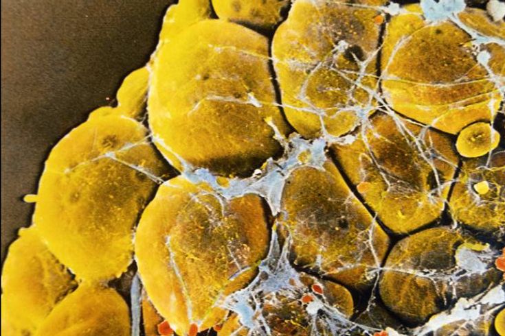 Các tế bào chất béo đều là ‘bọc bong bóng’ của cơ thể