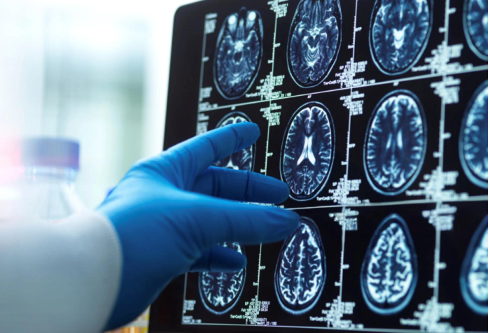 Não của những người khỏe mạnh lão hóa nhanh hơn trong đại dịch Covid-19